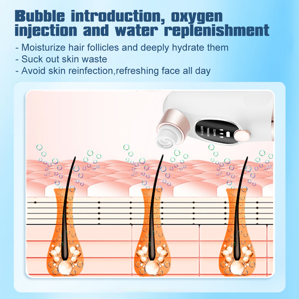 Vacuum Suction Face & Nose Pore Cleaner – Deep Cleansing Beauty Device